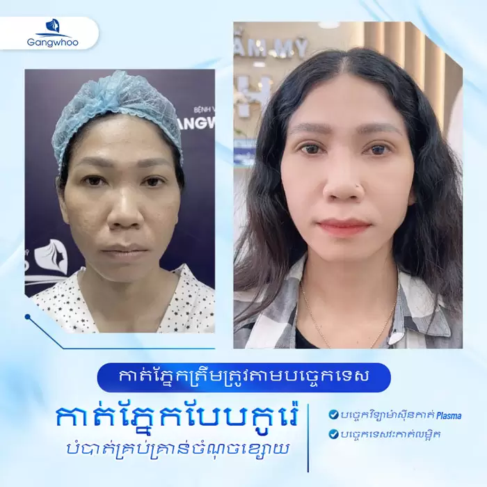 km cat mi han quoc 7