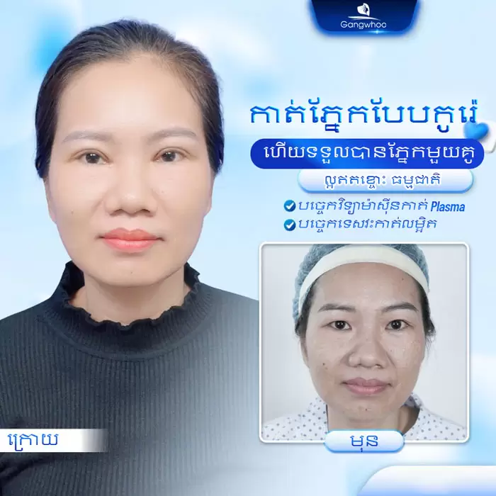 km cat mi han quoc 8