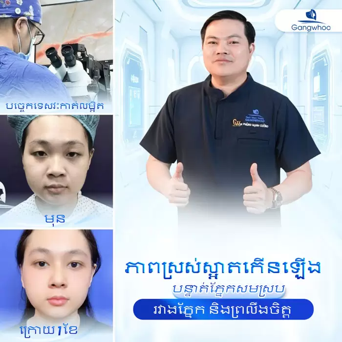 km cat mi han quoc 9