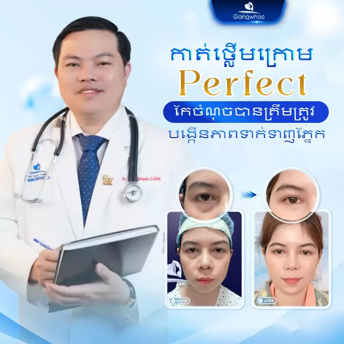 km cat mi perfect 3