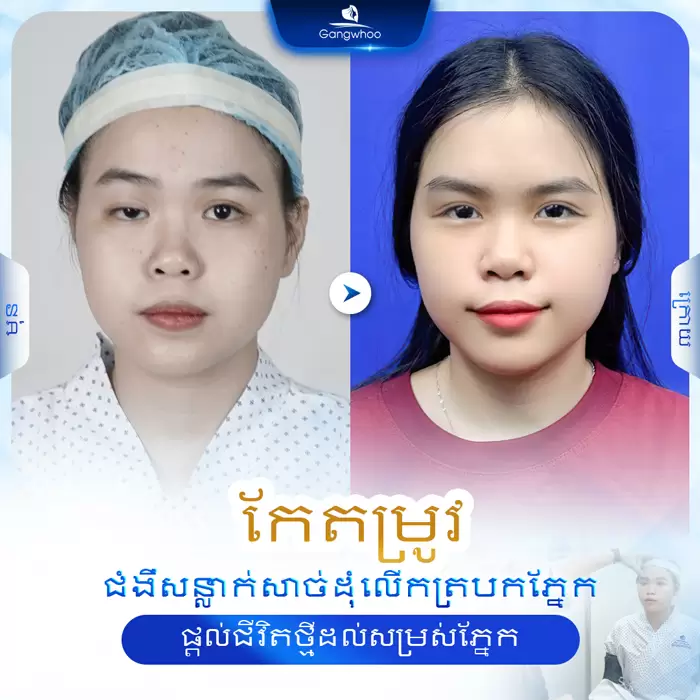 km chinh sup mi 1