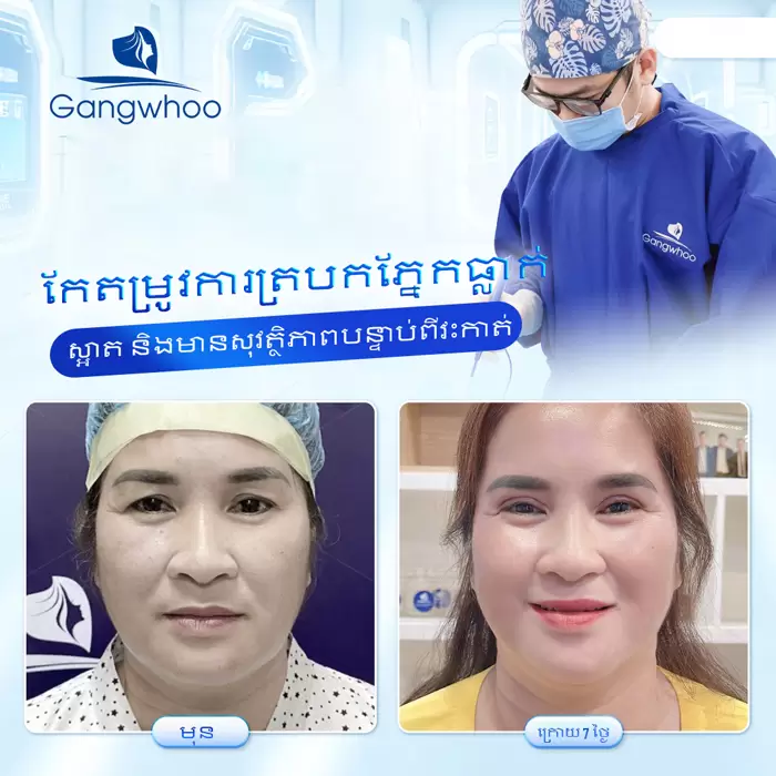 km chinh sup mi 3