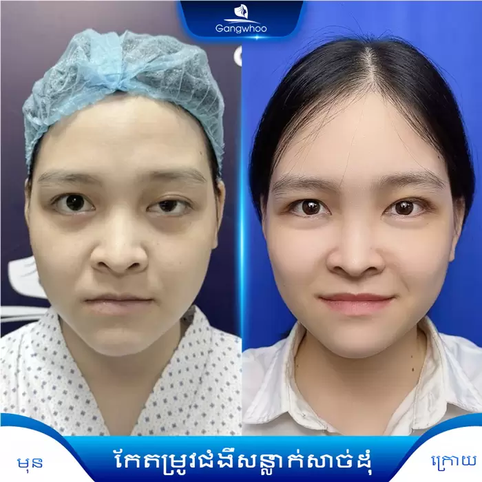 km chinh sup mi 4