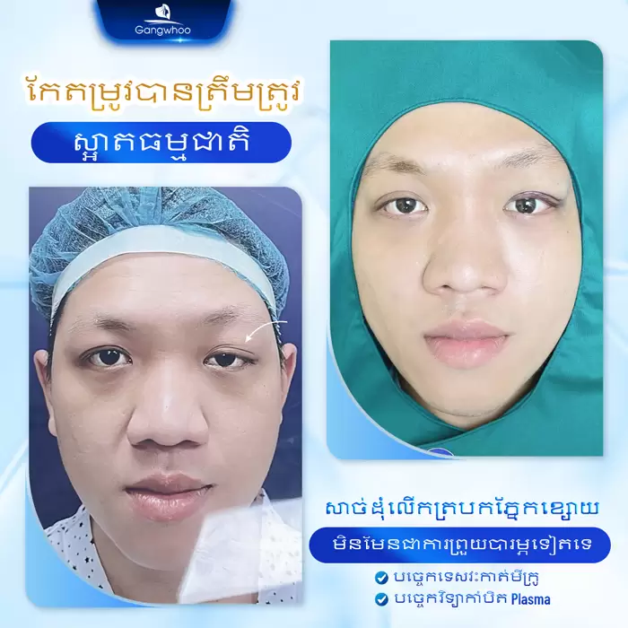 km chinh sup mi 5