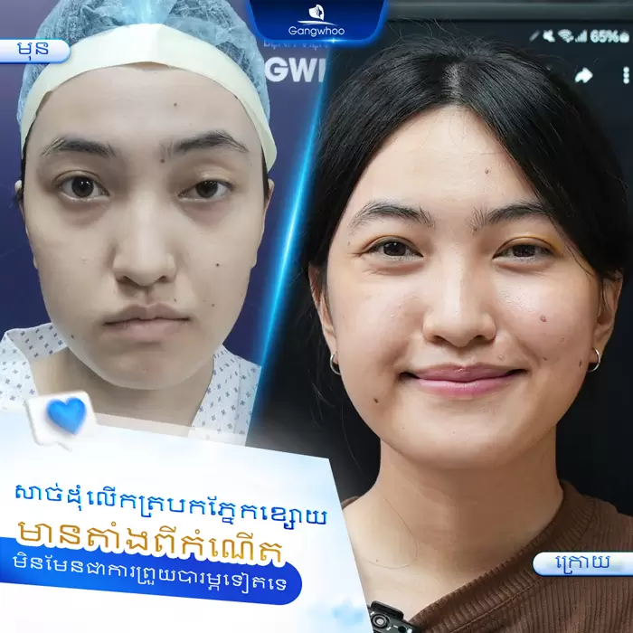km chinh sup mi 6