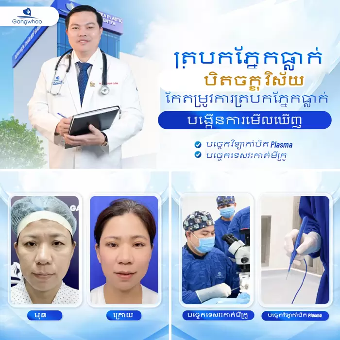 km chinh sup mi 7