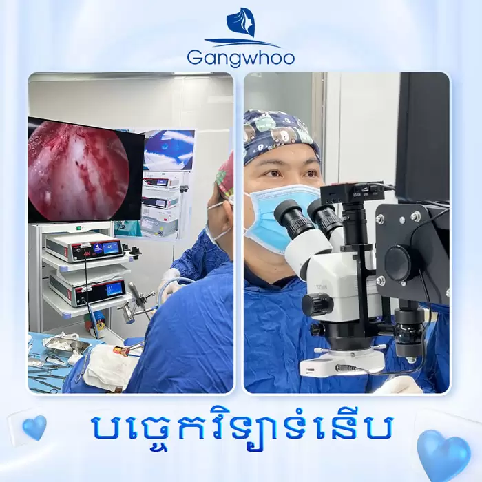 km lay mo mat noi soi 5