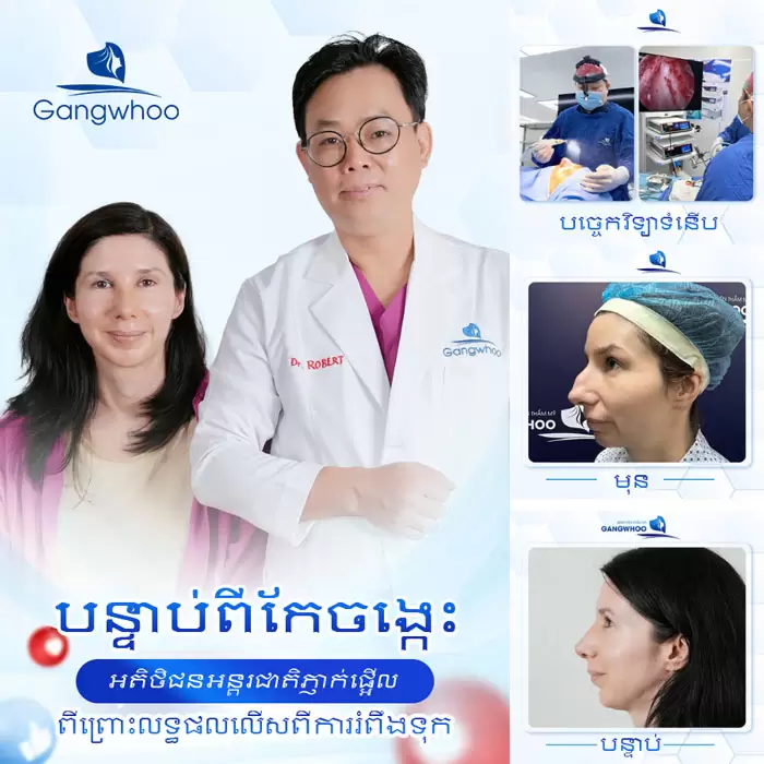 km mai go xuong mui 2