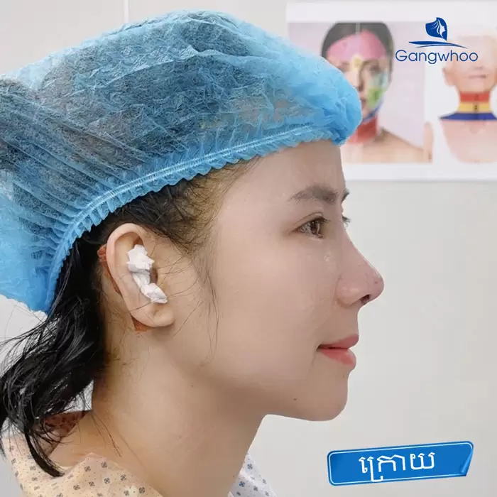 km nang mui bang chi 2