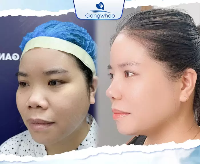 km nang mui bang chi 3