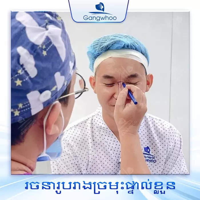 km nang mui bang chi 4