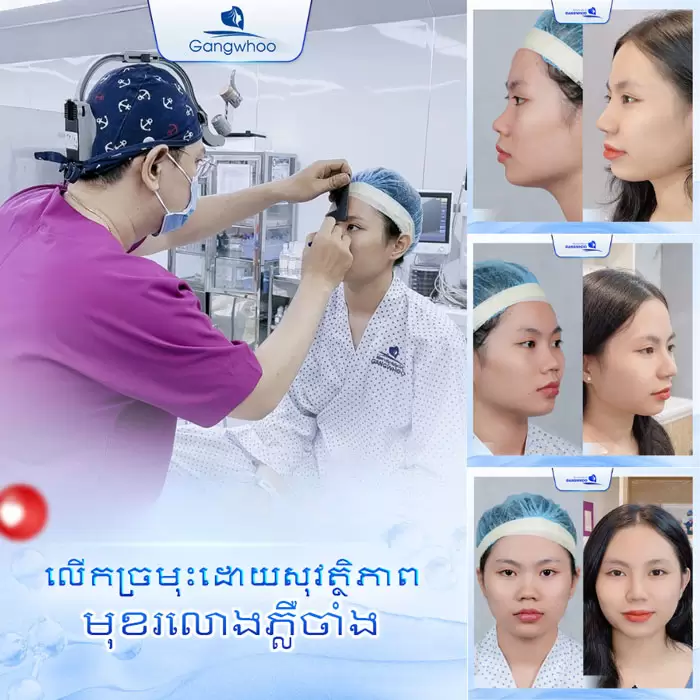 km nang mui bang chi 5