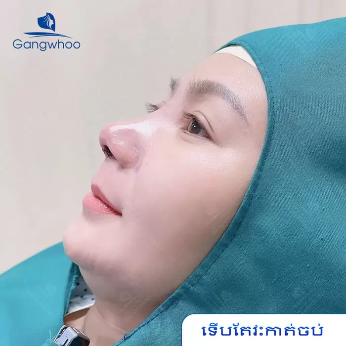 km nang mui bang chi 7