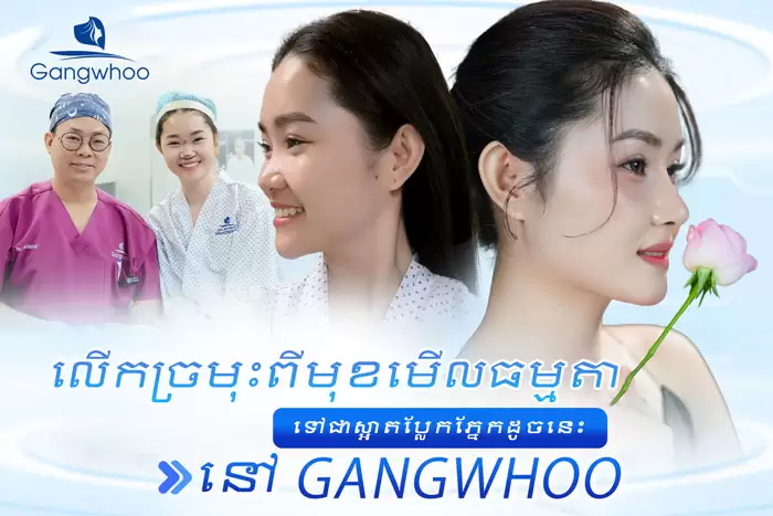 ការពែទ្យកែសម្ផស្សច្រមុះបែបកូរ៉េ – អាថ៌កំបាំងនៃការមានទម្រង់ច្រមុះបែបកូរ៉េ 2 km nang mui han quoc 11