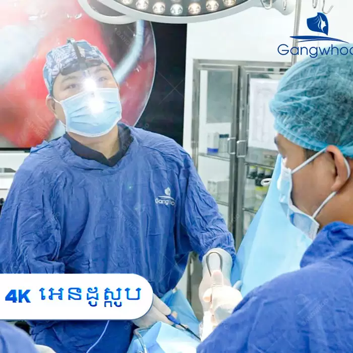 km nang mui nanoform 1