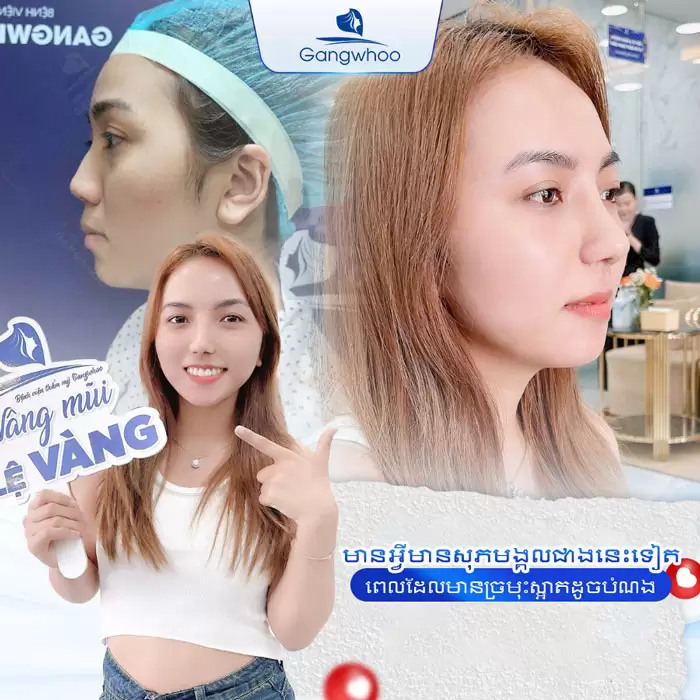 km nang mui nanoform 5