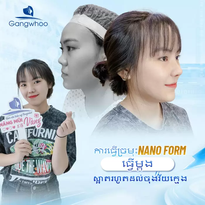 km nang mui nanoform 7