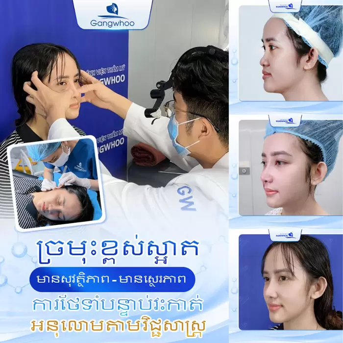 km nang mui nanoform 8