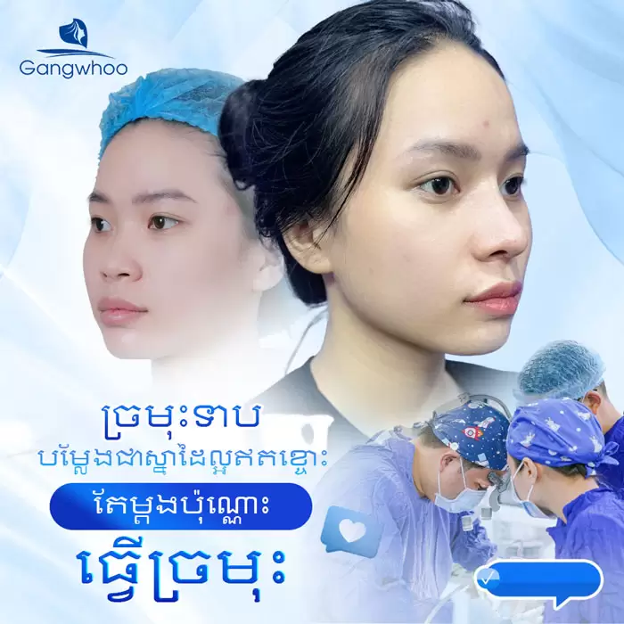 km nang mui nanoform 9