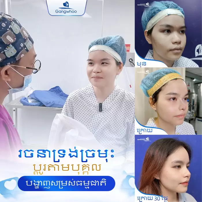 km nang mui sun sugiform 1