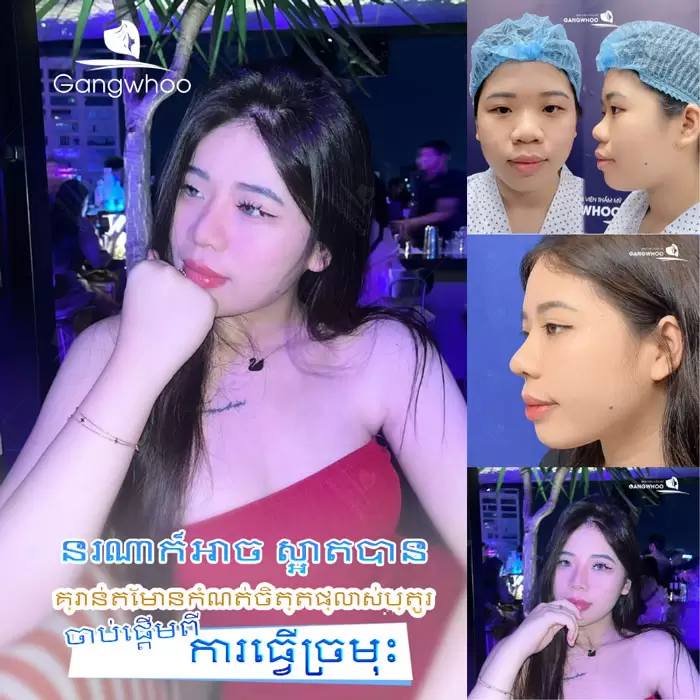 km nang mui sun suon 10