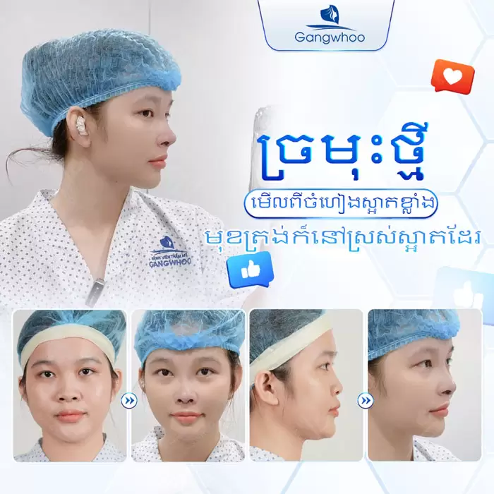 km nang mui sun suon 2