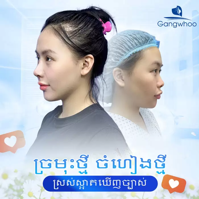 km nang mui sun suon 9