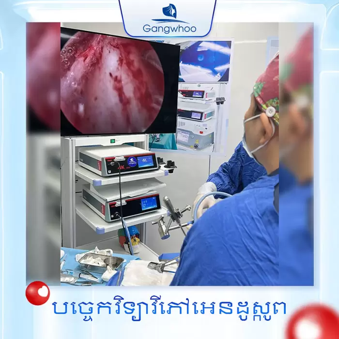 បង្រួមស្លាបច្រមុះ កែច្រមុះធំ ទូលាយ ឱ្យក្លាយជារាងស្លីម 15 km thu gon canh mui 9