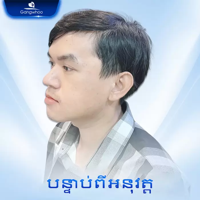 km truot cam 10