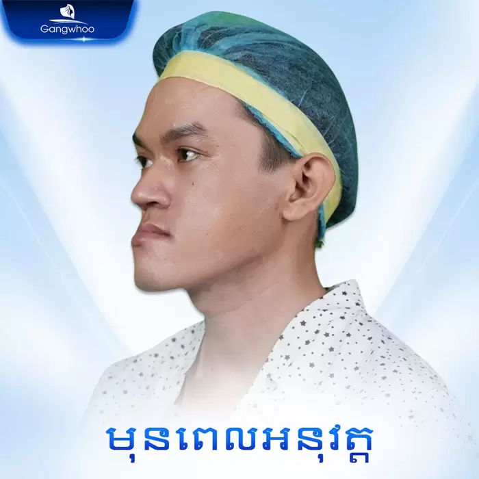 km truot cam 11