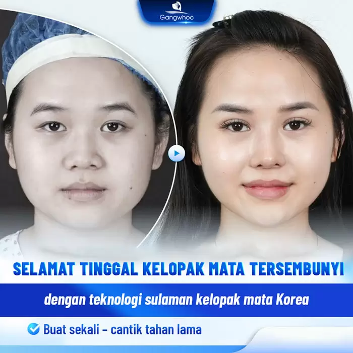 ms bam mi han quoc 3