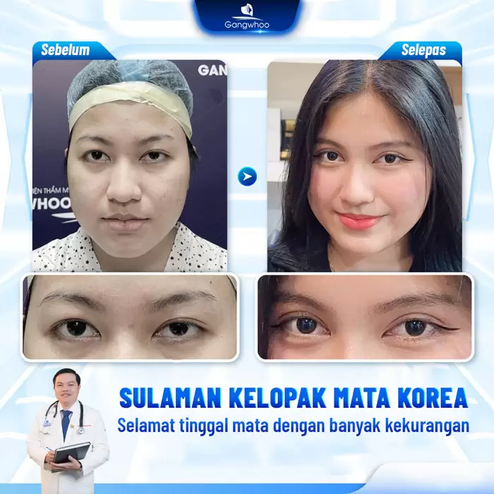 ms bam mi han quoc 7