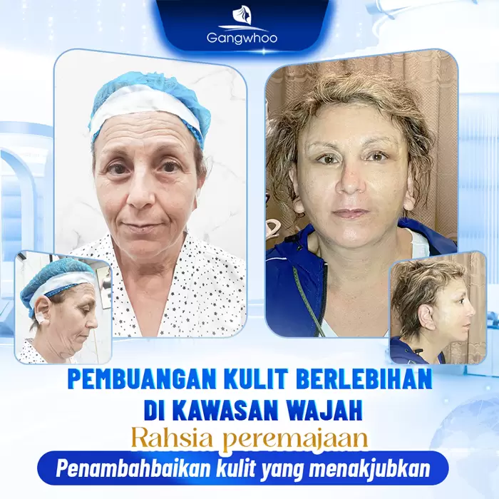 ms cat da thua vung mat 2