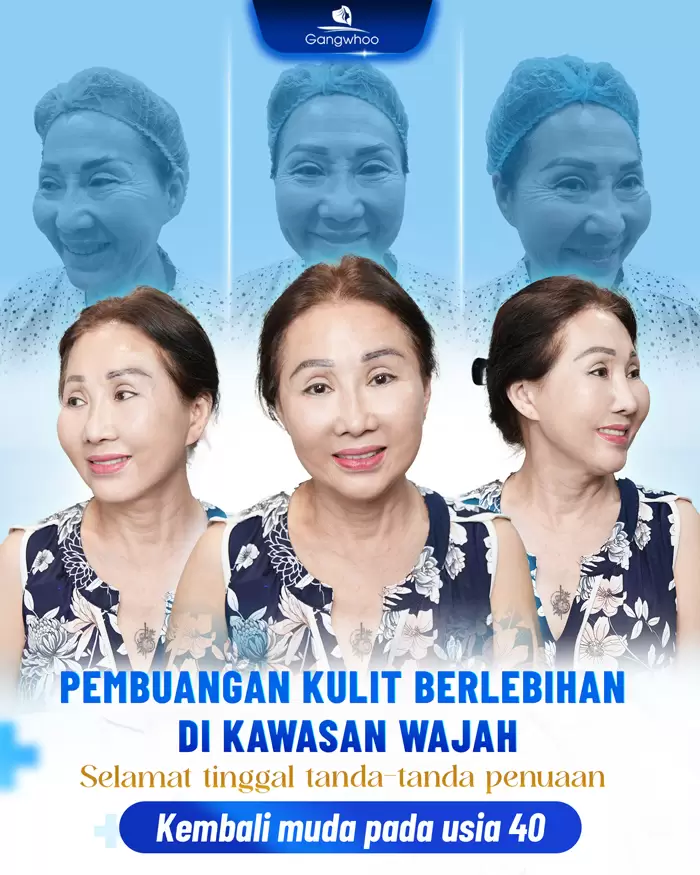 ms cat da thua vung mat 4