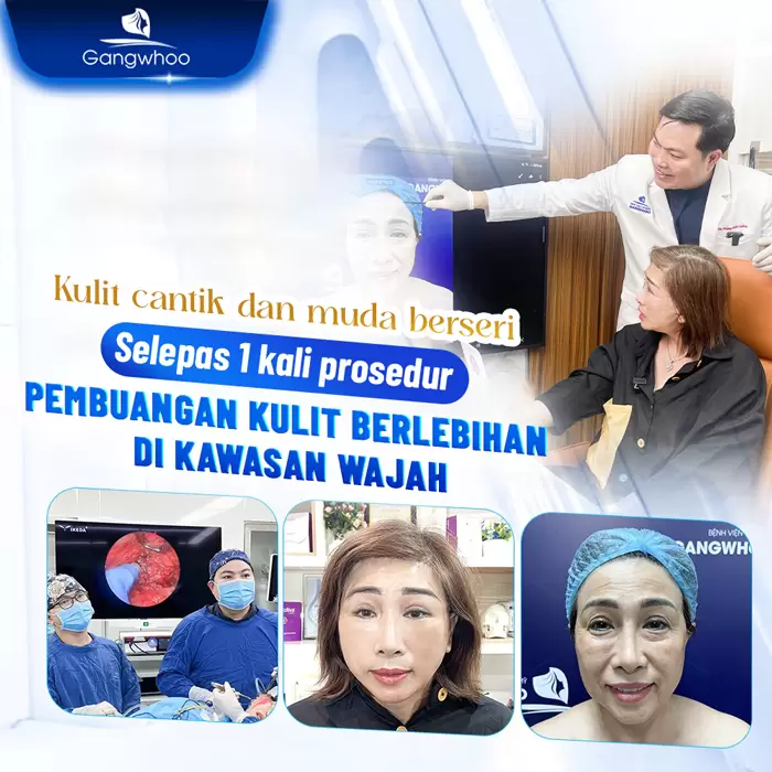 ms cat da thua vung mat 9