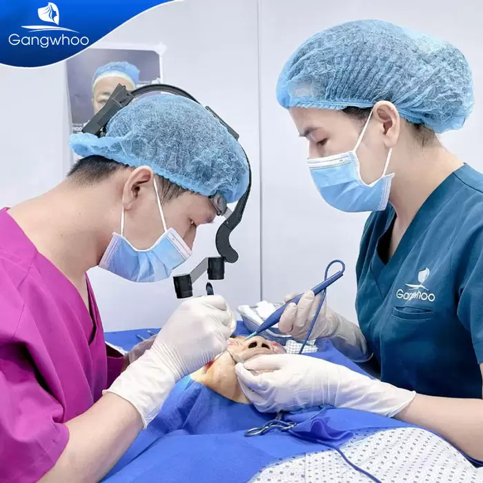 Potongan Kelopak Mata 4 dalam 1 Plasma: Memperbaiki Segala Kekurangan, Mata Dua Kelopak yang Cantik Sempurna 7 ms cat mi 4 in 1 10