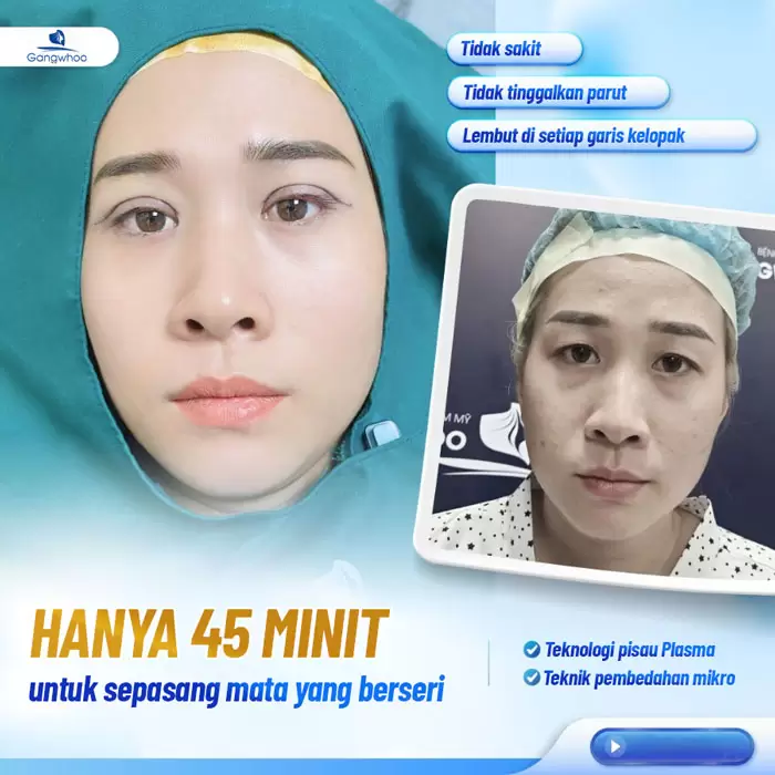 Potongan Kelopak Mata 4 dalam 1 Plasma: Memperbaiki Segala Kekurangan, Mata Dua Kelopak yang Cantik Sempurna 8 ms cat mi 4 in 1 11