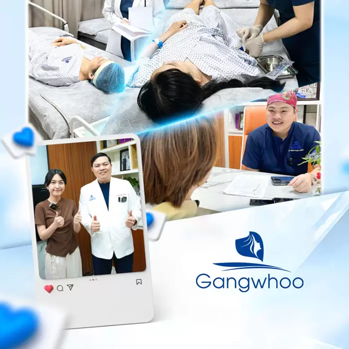 Potongan Kelopak Mata 4 dalam 1 Plasma: Memperbaiki Segala Kekurangan, Mata Dua Kelopak yang Cantik Sempurna 20 ms cat mi 4 in 1 12