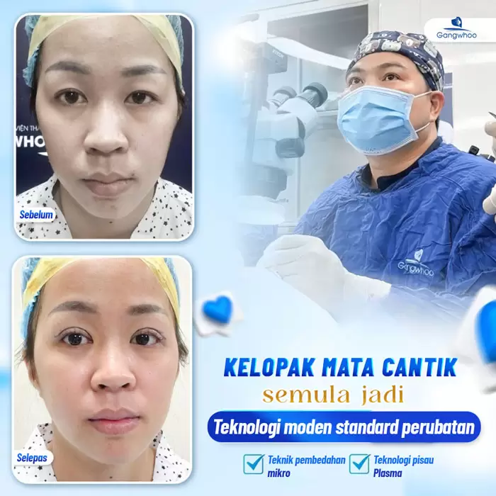 Potongan Kelopak Mata 4 dalam 1 Plasma: Memperbaiki Segala Kekurangan, Mata Dua Kelopak yang Cantik Sempurna 4 ms cat mi 4 in 1 2