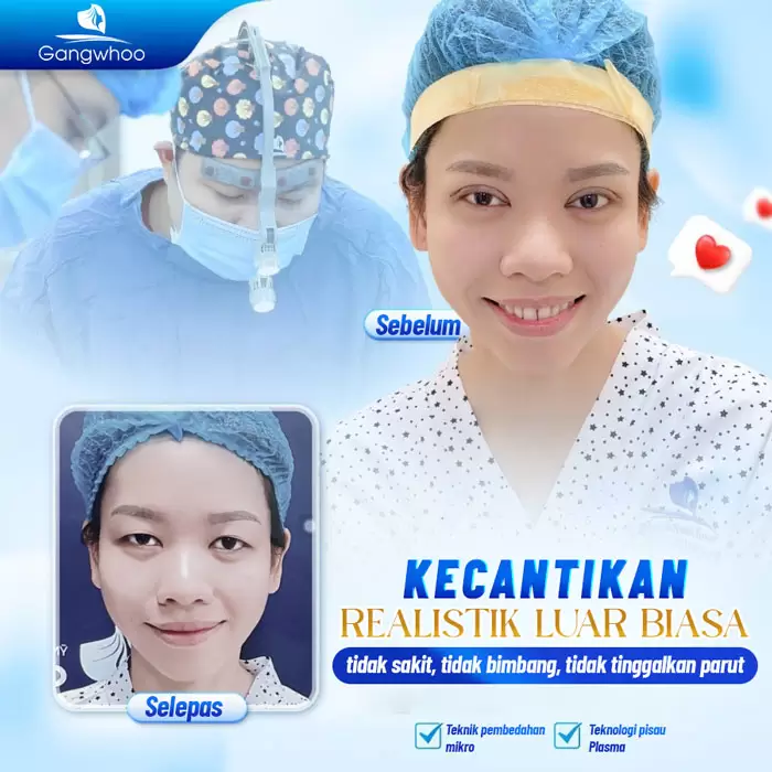 Potongan Kelopak Mata 4 dalam 1 Plasma: Memperbaiki Segala Kekurangan, Mata Dua Kelopak yang Cantik Sempurna 18 ms cat mi 4 in 1 3