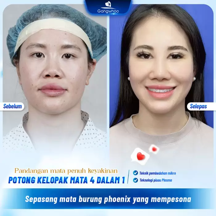 Potongan Kelopak Mata 4 dalam 1 Plasma: Memperbaiki Segala Kekurangan, Mata Dua Kelopak yang Cantik Sempurna 5 ms cat mi 4 in 1 4