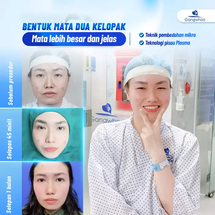 Potongan Kelopak Mata 4 dalam 1 Plasma: Memperbaiki Segala Kekurangan, Mata Dua Kelopak yang Cantik Sempurna 6 ms cat mi 4 in 1 5