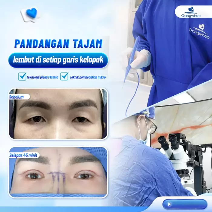 Potongan Kelopak Mata 4 dalam 1 Plasma: Memperbaiki Segala Kekurangan, Mata Dua Kelopak yang Cantik Sempurna 19 ms cat mi 4 in 1 6
