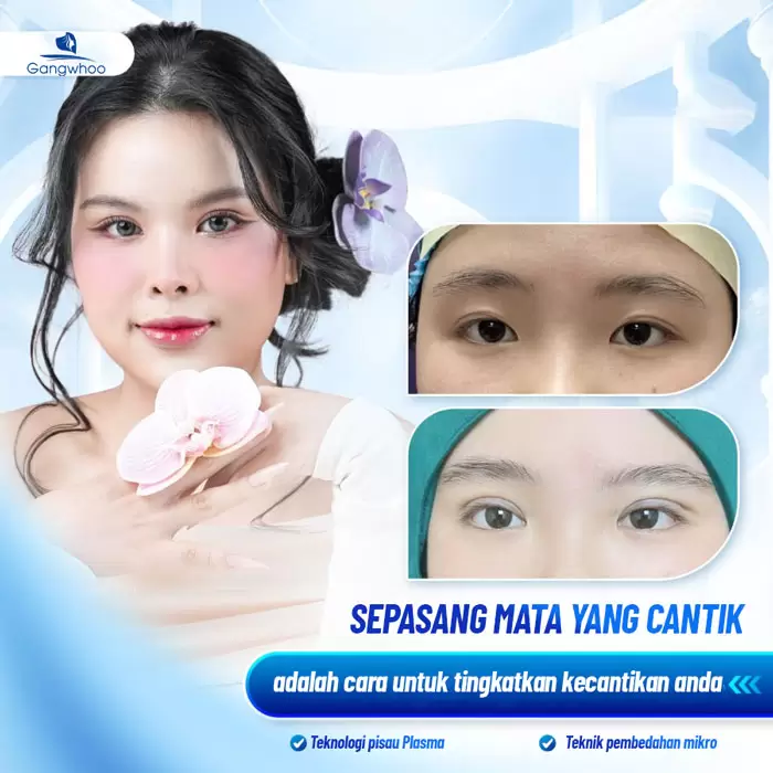 Potongan Kelopak Mata 4 dalam 1 Plasma: Memperbaiki Segala Kekurangan, Mata Dua Kelopak yang Cantik Sempurna 1 ms cat mi 4 in 1 8