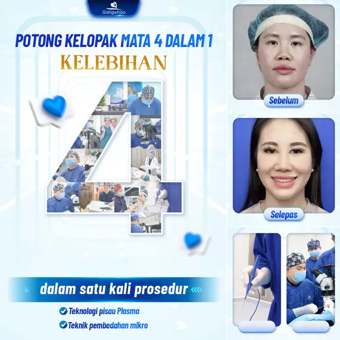 Potongan Kelopak Mata 4 dalam 1 Plasma: Memperbaiki Segala Kekurangan, Mata Dua Kelopak yang Cantik Sempurna 3 ms cat mi 4 in 1 9
