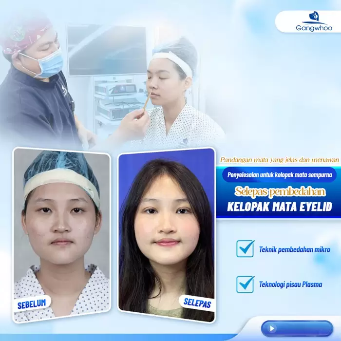 ms cat mi eyelid 6