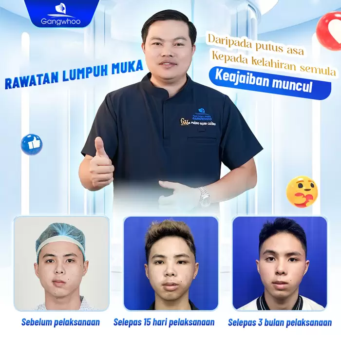 ms dieu tri liet mat 10