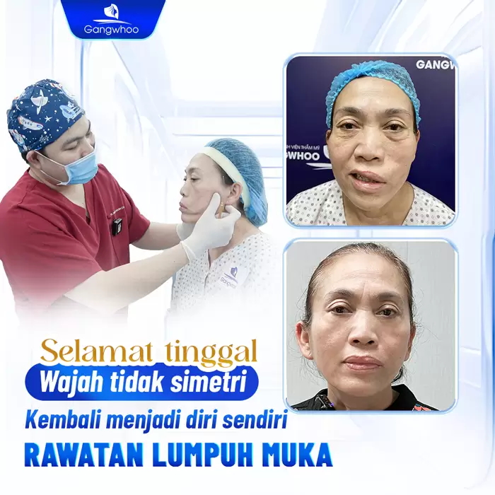 ms dieu tri liet mat 9