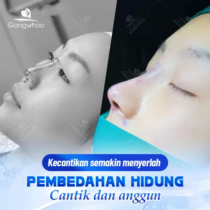 ms nang mui bang chi 10