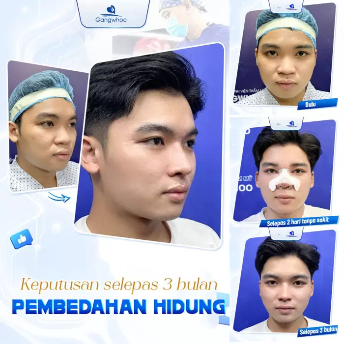 ms nang mui cau truc 2